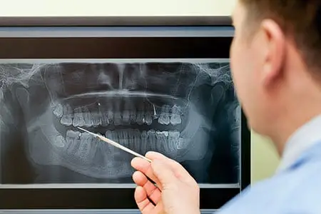 person looking at x-ray